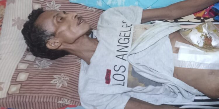 JKN-KIS Bantu Memet Berjuang Melawan Usus Buntu Kronis